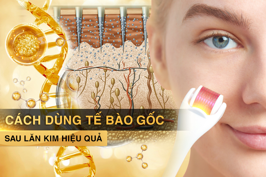 Cách dùng tế bào gốc sau lăn kim hiệu quả