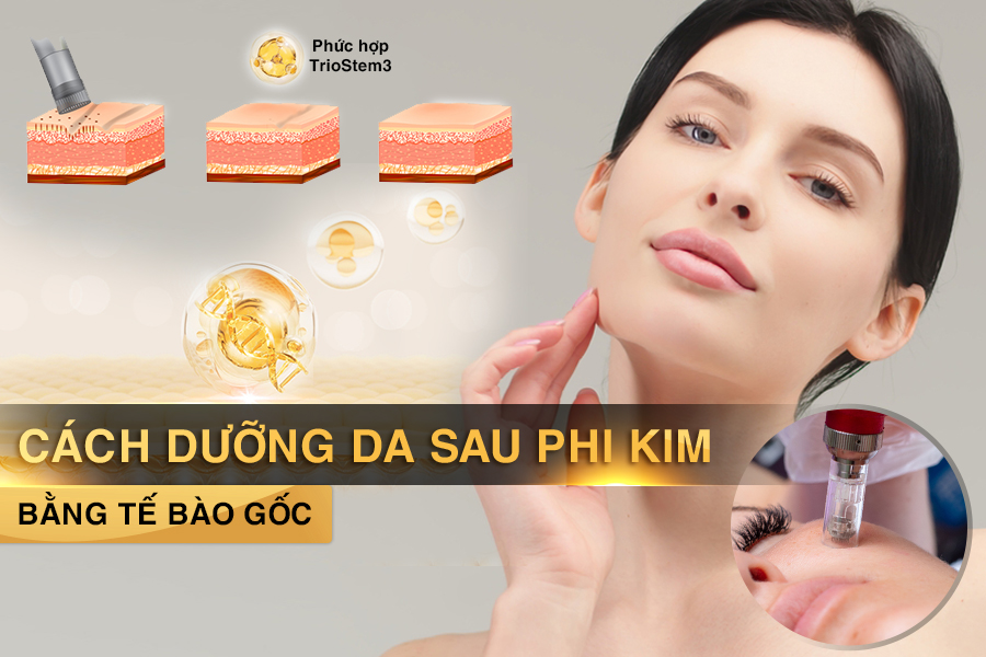 cách dưỡng da sau phi kim bằng tế bào gốc