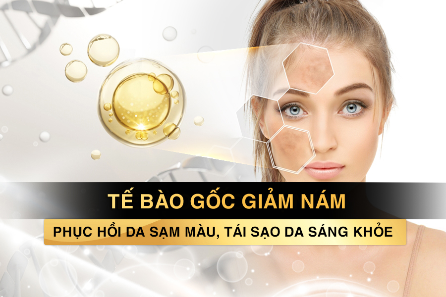 tế bào gốc trị nám