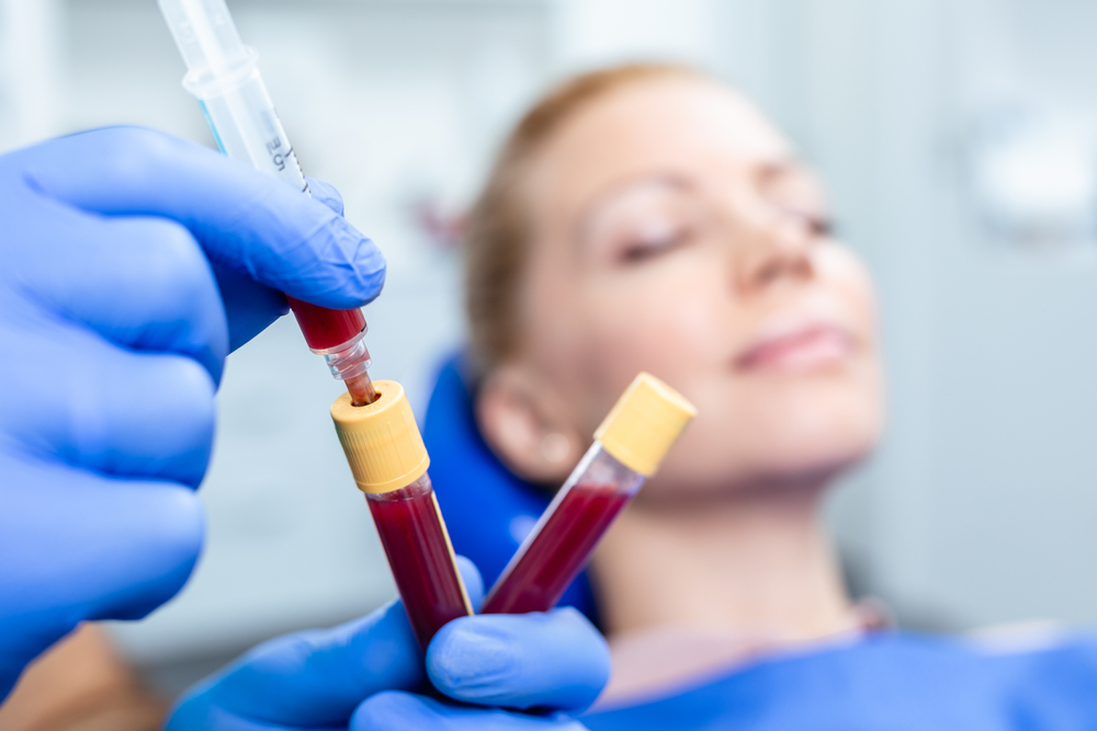 Tiêm tế bào gốc trị sẹo rỗ bằng huyết tương Therapy