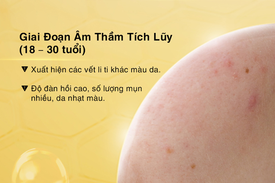 giai đoạn tích lũy lão hóa da