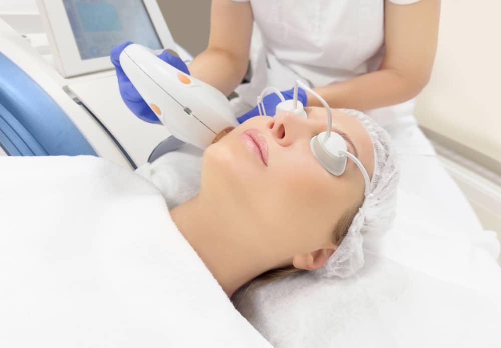 tăng sắc tố sau viêm điều trị laser gây nám da ở phụ nữ