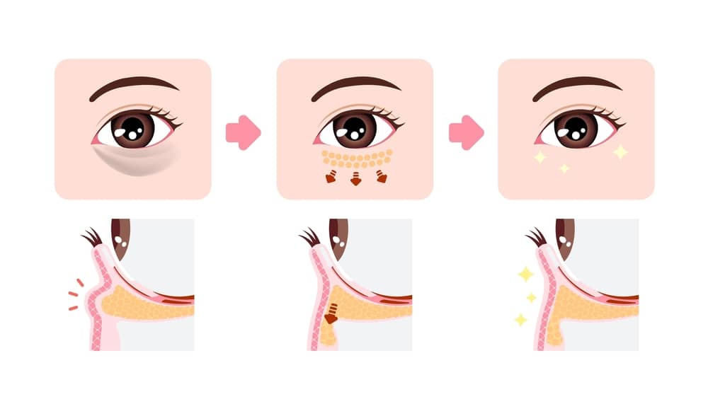 cơ chế tác động của fs eyedark