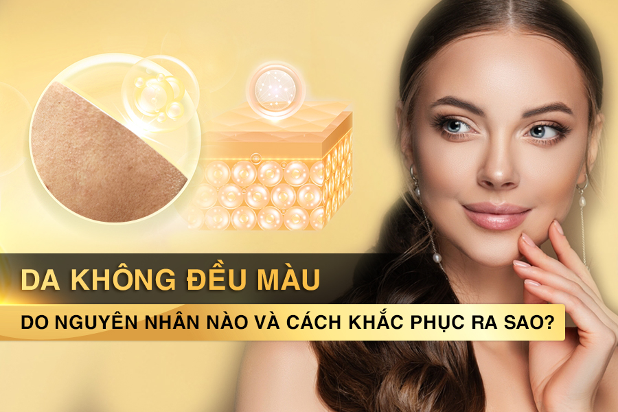 da không đều màu
