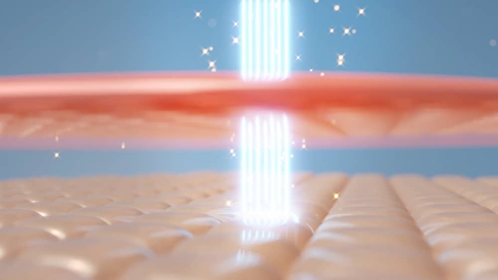 tia laser tác động sâu vào làn da