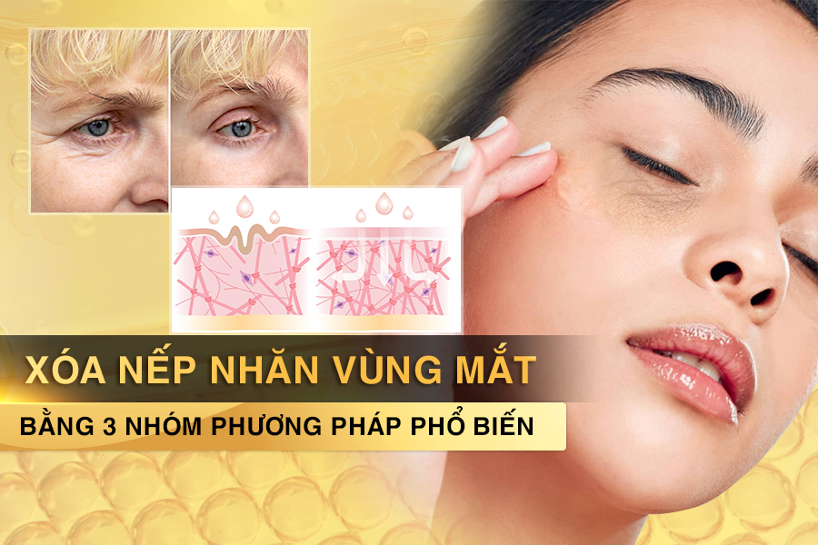xóa nếp nhăn vùng mắt